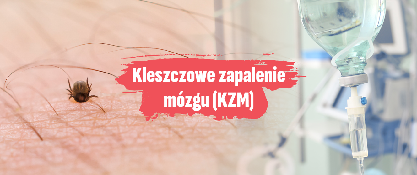 30 marca - Ogólnopolski Dzień Świadomości Kleszczowego Zapalenia Mózgu