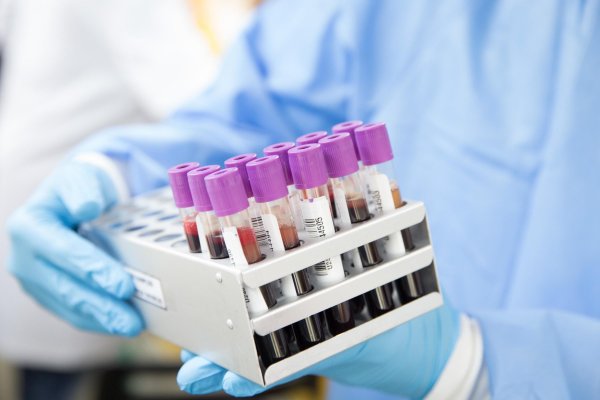 „Testuj. Lecz. Zapobiegaj”. Europejski Tydzień Testowania w Gdyni